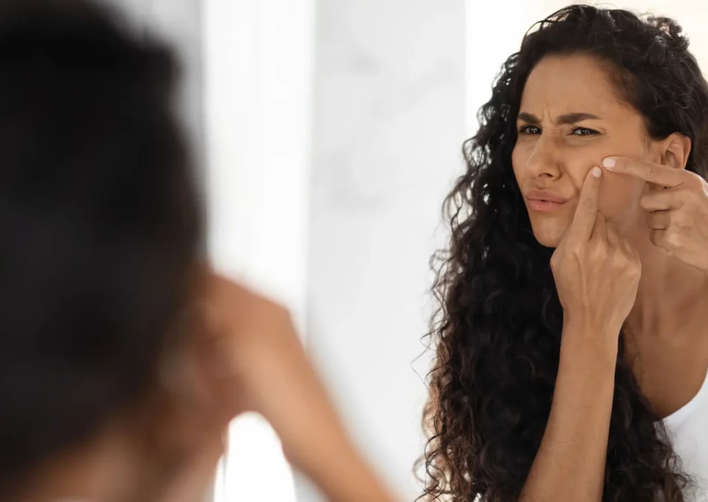 femme métisse qui remarque de l'acné sur sa peau