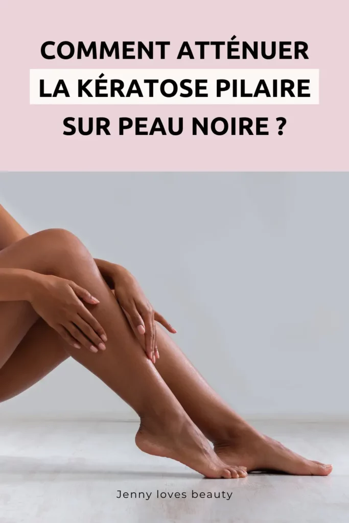 Comment atténuer la kératose pilaire ?