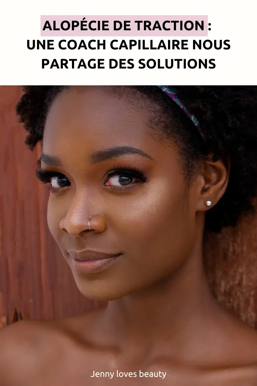 Alopécie de traction sur cheveux crépus